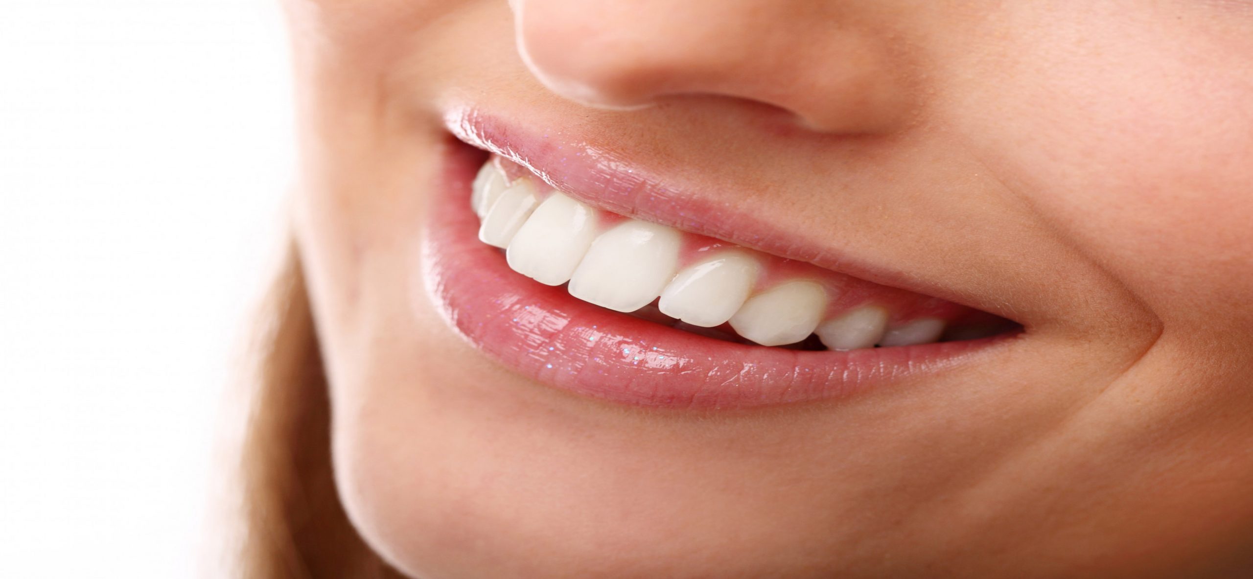 Blancorexia: obsesión por los dientes blancos
