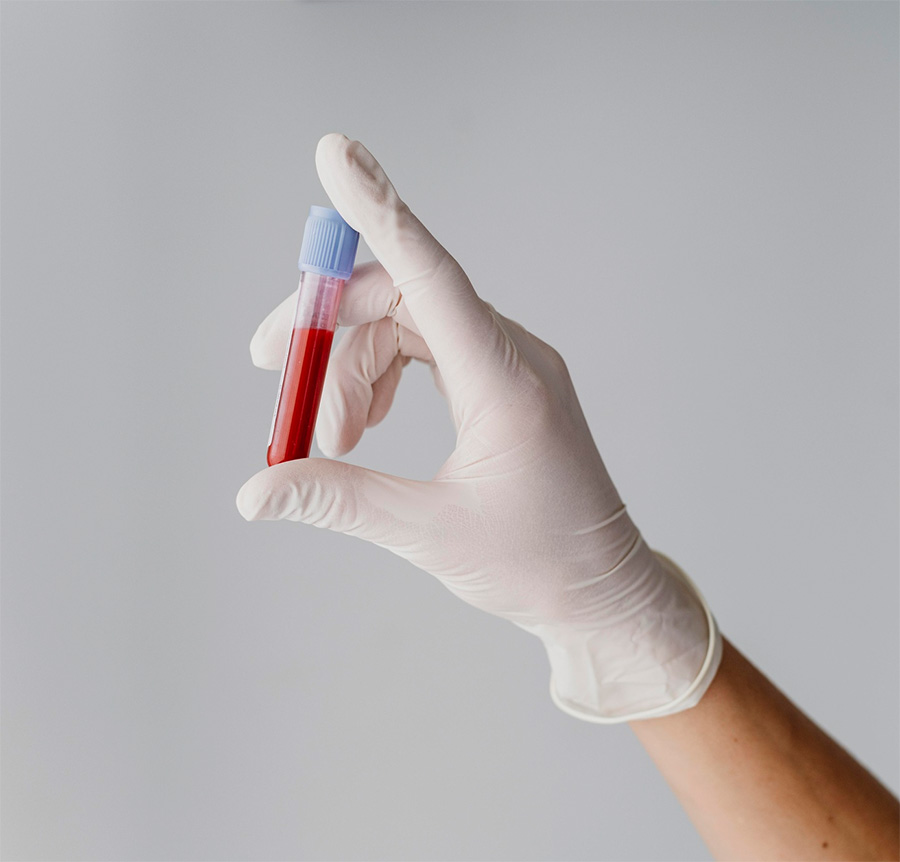 mano de sanitario con guante de latex sostiene un tubo de ensayo con muestra de sangre